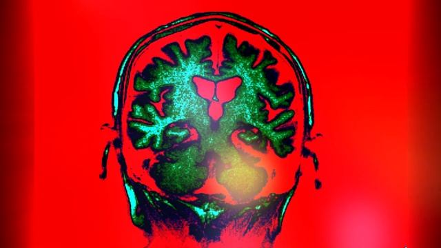 Люди с феноменальными способностями (1 часть) смотреть онлайн