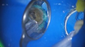 эндодонтия 17