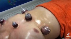 хиджама в Москве