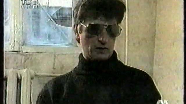 Анатолий Барбакару Фото До И После Пластики