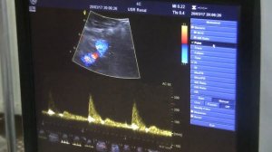 Носенко Е.М. Ультразвуковое исследование аорты и ее ветвей. Обучение.