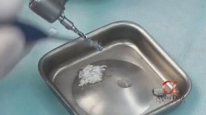 Установка зубных имплантов на нижней челюсти