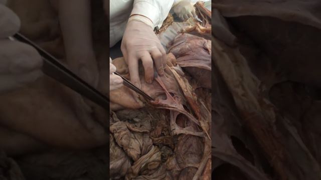 Сосуды туловища смотреть онлайн