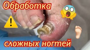 Обработка сложных ногтей ?⚠️???