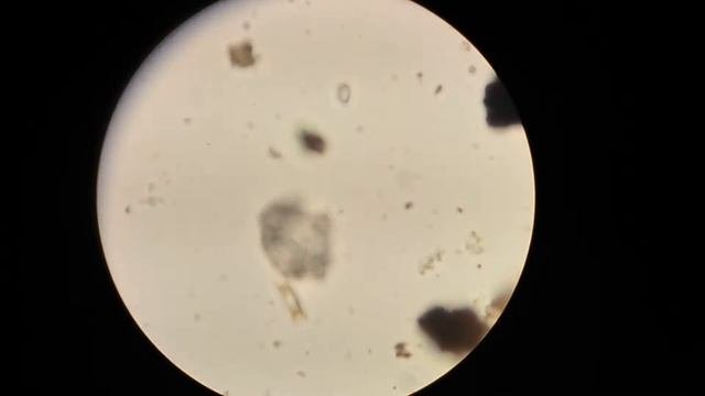 Диатомовые водоросли под микроскопом