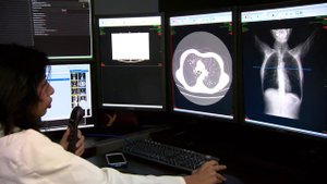 Компьютерная томография (КТ) позвоночника