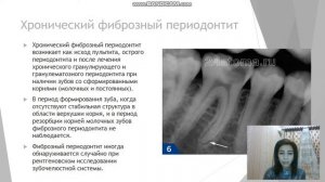 Периодонтит