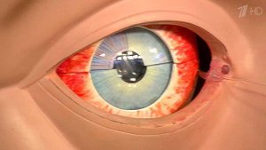 Травма роговицы. "Песок" в глазах. Жить здорово! Фрагмент выпуска от 18.05.2015