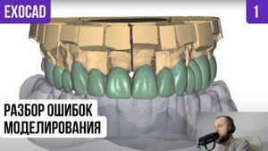 EXOCAD разбор ОШИБОК моделирования реальный клинический случай. Ошибки Exocad Моделирование цифра