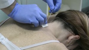 Внутритканевая электростимуляция