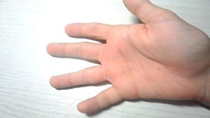 Что делать если разбил экран на телефоне