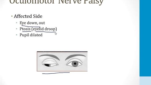 Неврология USMLE - 5. Глаз - 4.Движения глаз