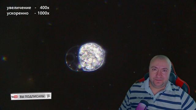 Необычная гибель инфузории | Темное поле смотреть онлайн