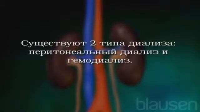 Диализ