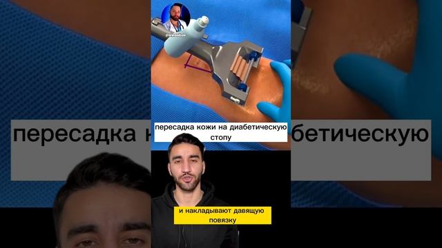 пересадка кожи смотреть онлайн