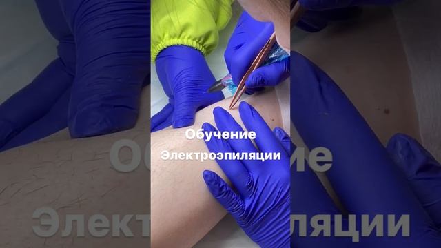 Обучение электроэпиляции