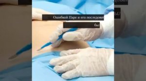 Кесарево Сечение - Королевский Разрез