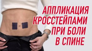 ✅ АППЛИКАЦИЯ КРОСС ТЕЙПАМИ ПРИ БОЛИ В СПИНЕ | Валентин Гайт | Учебный центр BBALANCE