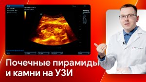 Как качественно оценить паренхиму на УЗИ почек и отличить мозговое вещество?