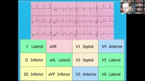 12 LEAD EKG STEMI Interpretation with Coronary Anatomy, Rx: ASA, O2, Nitro, OLMC Call Per NYC REMAC