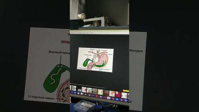 Рефлюкс  заброс кислоты в желудок