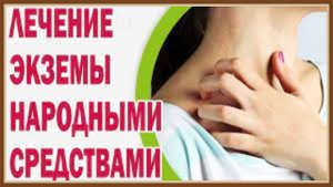 ЛЕЧЕНИЕ ЭКЗЕМЫ НАРОДНЫМИ СРЕДСТВАМИ