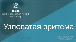 353  Узловатая эритема