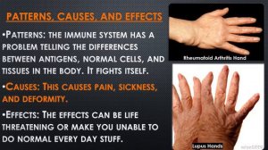 Fighting Lupus and Rheumatoid Arthritis