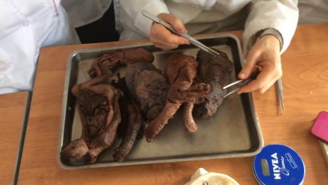 Анатомия легких