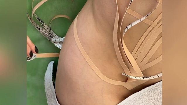 Тейпирование для улучшения метаболизма