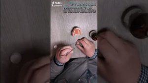 ЗУБНЫЕ ПРОТЕЗЫ. Ремонт перелома съемного зубного протеза.