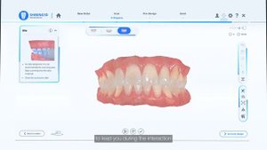 SHINING 3D Aoralscan 3 Intraoral scanner introduction video