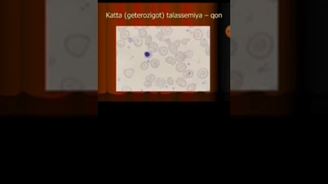 Anemiyalar смотреть онлайн