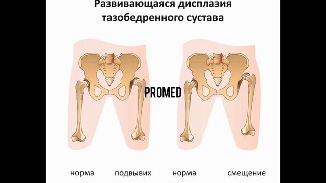 Теледидардан порно видеолар тарап кетті DIY тізбекті тойтарғыш