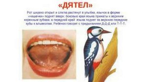 Артикуляционное упражнение Дятел. Упражнение Дятел как сделать правильно_ Детский логопед.