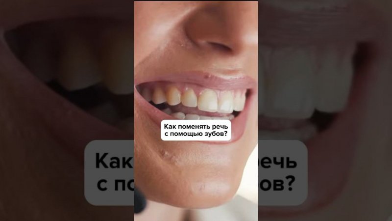 Подробнее смотри в полном видео на нашем канале STARTSMILE