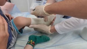 СЕРЁЖЕ ПОМЕНЯЛИ ГИПС НА ПОЛИМЕРНЫЙ | ОТИТ И РАСЩЕЛИНА НЁБА
