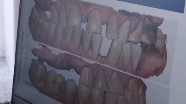 «3D - сканирование в стоматологии. Цифровые технологии в  клинике «Новая Стоматология»