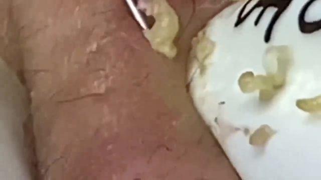 Enjoy Every Day With Loan Nguyen Spa Beauty New Video | 004
