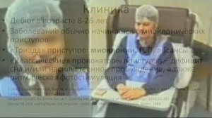 Юношеская миоклоническая эпилепсия  Часть 1