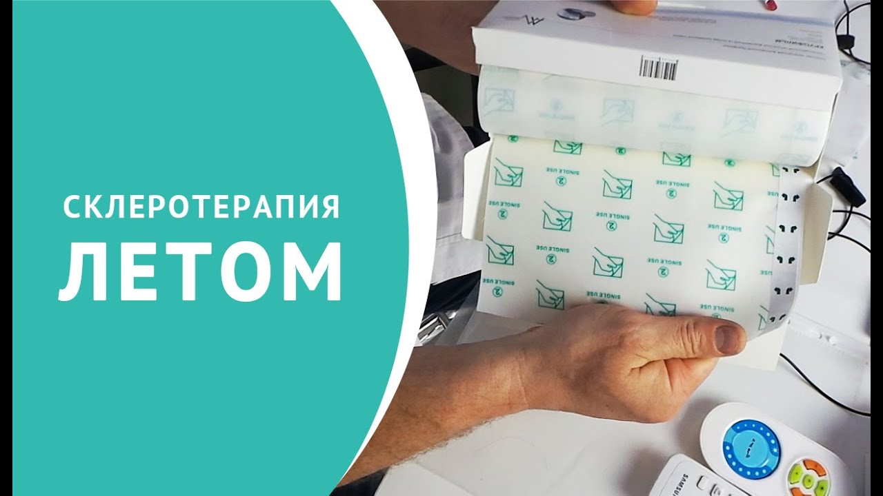 Склеротерапия летом, как делать правильно
