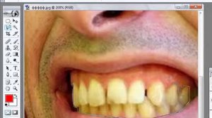 Создание белоснежной улыбки.mp4