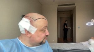 Пересадка волос в Турции