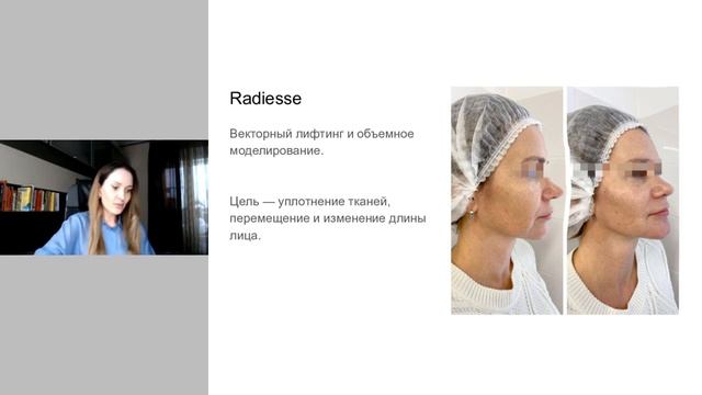 Контурная Пластика Лица 1 день — бесплатный мастер-класс. Яна Ащина. смотреть онлайн