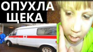 ОПУХЛА ЩЕКА у ребенка / провели целый день в БОЛЬНИЦЕ ВЛОГ
