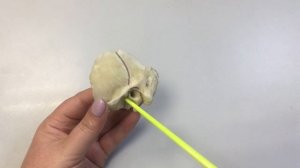 Височная кость