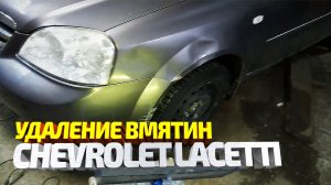 Удаление вмятин и ремонт крыла БЕЗ ПОКРАСКИ на автомобиле Шевроле Лачетти