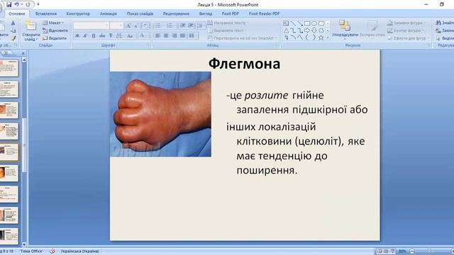 Л5 Хірургічна інфекція смотреть онлайн