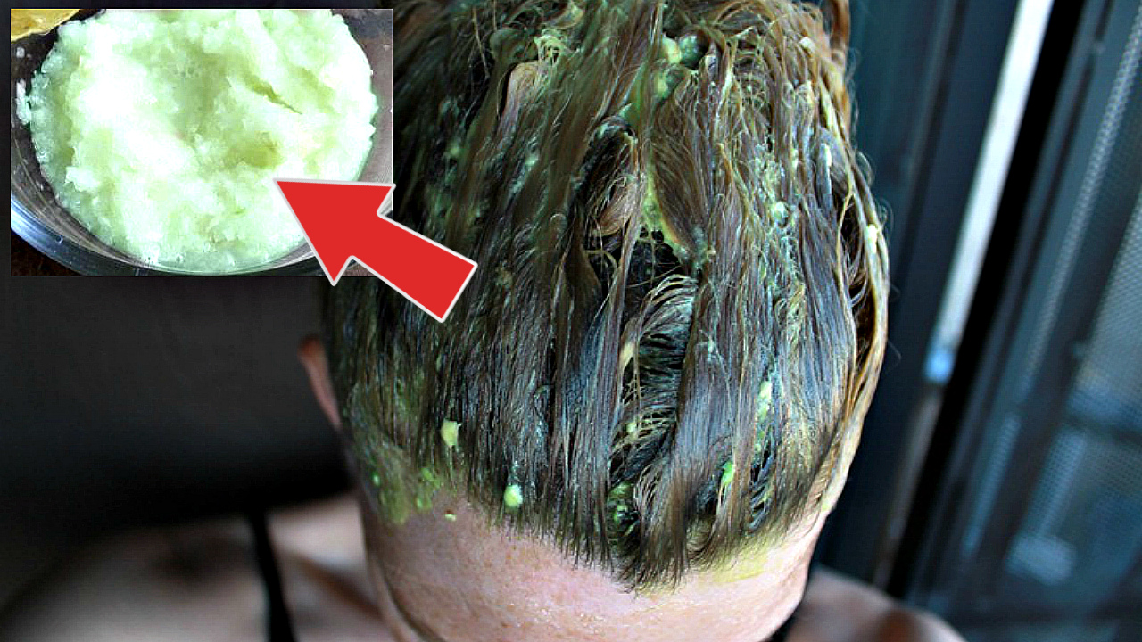 Волосы лезли невыносимо а спасла меня эта простая маска! Как приготовить луковую маску от выпадения? смотреть онлайн