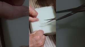 1.Остановка кровотечения в ране.